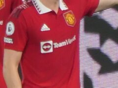 Manchester United Star Scott McTominay Recovers After Successful Heart Surgery